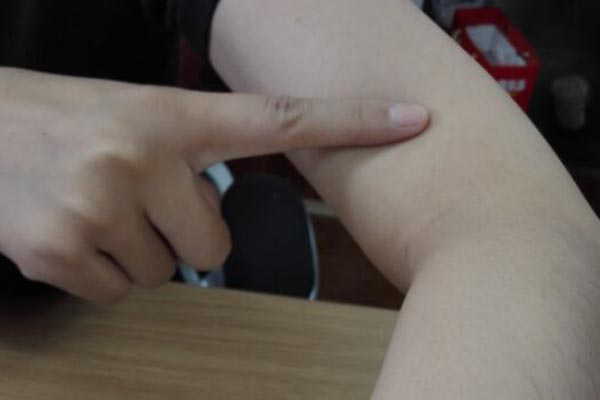 现在的天气变幻莫测，不注意添加衣服的话，手臂肌肉很容易受凉，从而会有胳膊疼痛的情况。