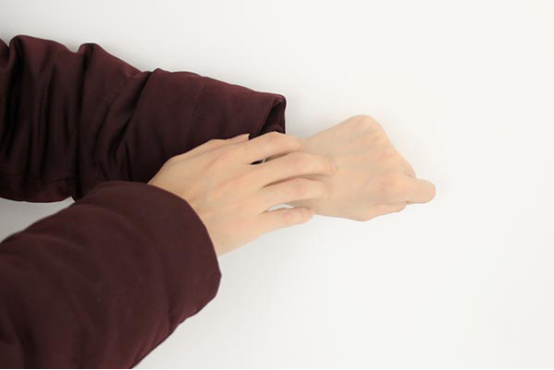 热油烫伤后怎么处理