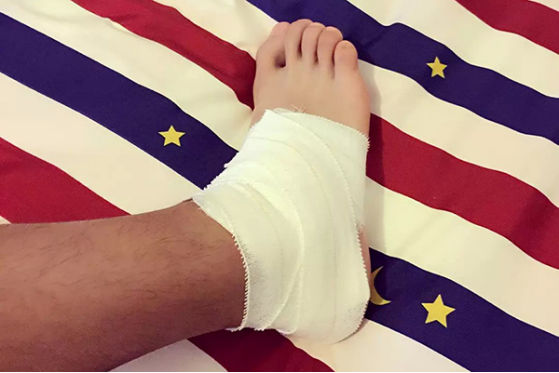 烫伤火辣辣疼要多久 烫伤火辣辣疼要多久