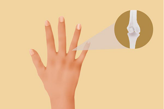 每个女生应该都经历过手发麻的情况，大多数是由于长时间遭受按压而导致的，经过一段时间缓解之后，手发麻现象就会自然而然的消失。