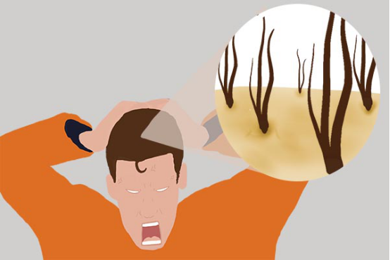 不少人应该都经历过头皮疼痛的现象，因为一段时间后就自动缓解了，所以很多人都没有重视起来，甚至是直接忽略掉。