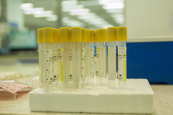 亲子鉴定是必要的时候大家需要采取的一种检验的手段。