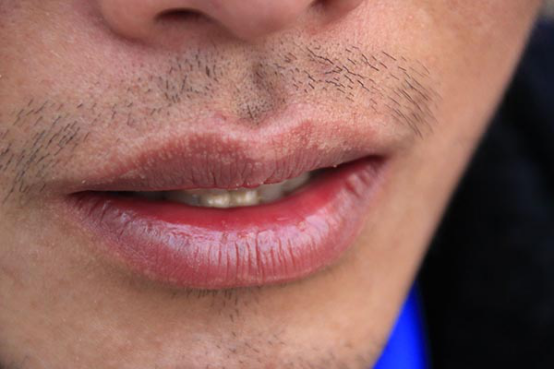 很多人在晚上睡觉的时候都会出现口干舌燥的情况，大多数人会采取喝水的方式进行缓解。