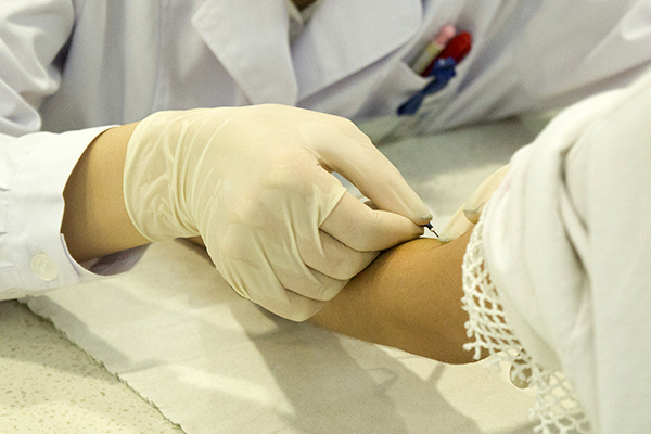 tsh通常是用来反映甲状腺功能是否正常的一种激素。