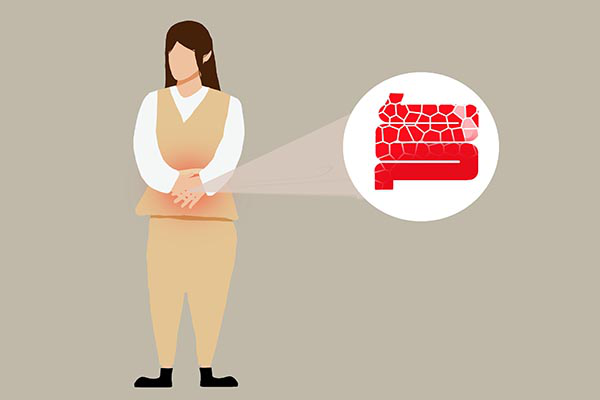 首先腹胀是因为有气在肠道里面，使得人们有腹胀的感觉。