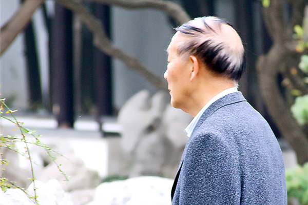 老年痴呆最初表现主要表现为记忆力出现下降。 老年痴呆最初表现主要表现为记忆力出现下降。