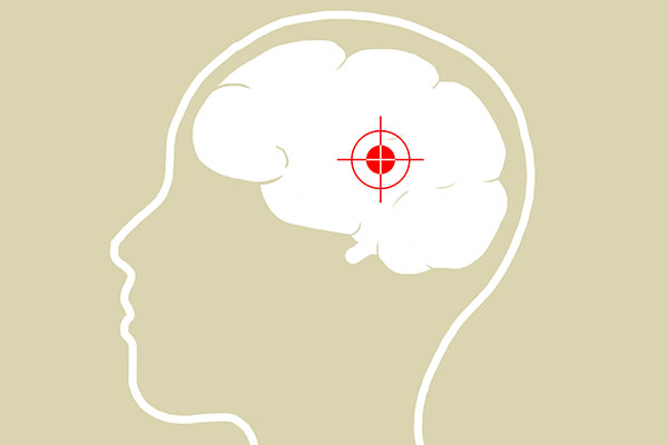 每个人的体质以及患有脑梗死的轻重程度是不一样的，因此，对于治疗脑梗死的结果也是不尽相同的。