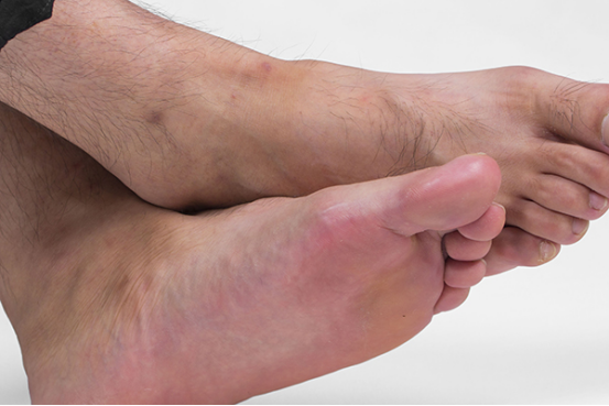 脚心热的睡不着怎么办