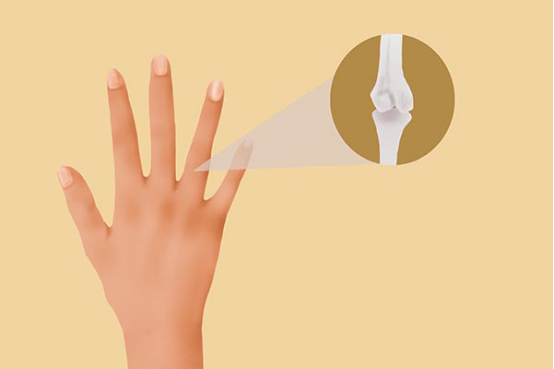 手指抽筋警惕四种病 手指抽筋警惕四种病