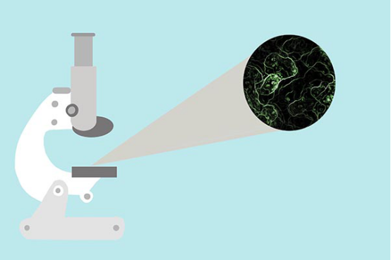 活检其实就是选择人们体内的一些细胞组织来进行活体的检查。