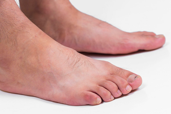 冬天天气比较冷的时候，脚还是容易出汗，有可能是因为人们体内阴虚火旺所导致的。