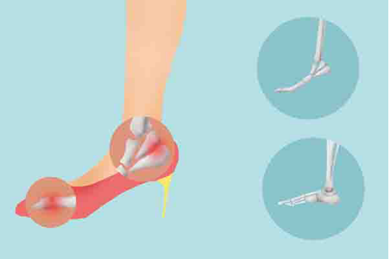 脚脖子疼其实也就是脚踝疼，在生活中，很多人都会遇到这种疼痛。