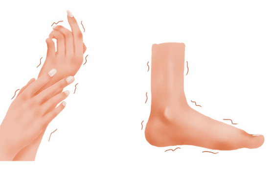 首先人们的身体在过度劳累或者是有贫血、营养不良等的问题之后，就很容易会产生四肢无力的情况。