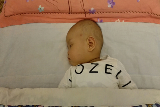 婴儿大便轻微血丝黏液