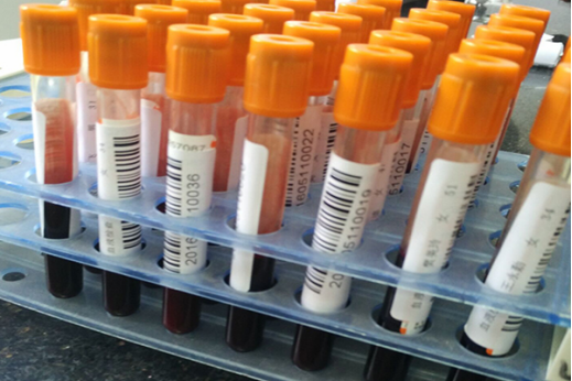 现在越来越多的人存在乙肝的困扰，不及时控制病情的话，对于肝脏的健康会有很大的影响。