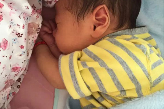 新生儿的皮肤比较敏感，容易出现黄疸的现象，这是正常的生理反应。