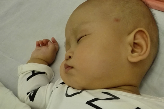 有些刚出生的宝宝在吃了母乳三四天后，皮肤会有变黄的现象，这种现象的发生与母乳性黄疸有一定的关系。