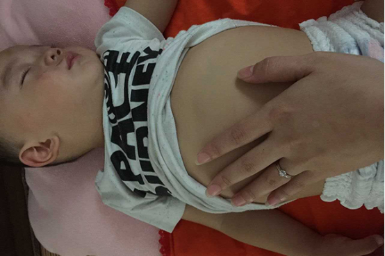 婴儿不耐乳糖可以观察孩子是否有持续拉肚子的症状，同时还会伴有大便呈青绿色稀糊状，部分宝宝的大便还带有酸臭味。