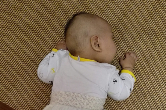 宝宝趴着睡觉容易导致宝宝出现窒息的危险，即使不会有生命危险，但对宝宝的生长发育也是不利的。