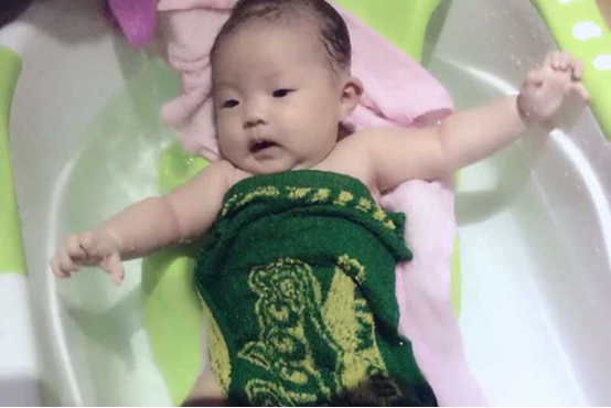 宝宝头上的胎垢是千万不能用手去抠的，宝宝的皮肤比较娇嫩，容易造成皮肤感染。