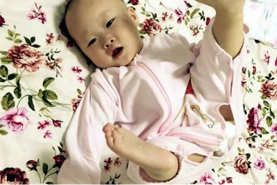 唐氏儿是指存在某些缺陷的儿童，对于家长来说，早期发现对于治疗唐氏儿有着极为重要的意义。