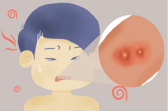 疫情结束之后，孩子们又开始放肆的大吃大喝，不注意饮食的话，就很容易出现口腔溃疡的情况。