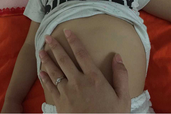 新生儿肚脐鼓起来这种现象是许多家长都会遇到的现象，这种情况会对新生儿健康造成一定的威胁，建议家长要引起注意。