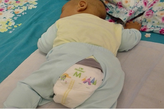 很多人起床的时候、吃东西的时候会出现放屁的情况，这是比较常见的，虽然不是很文雅，但是也是人们正常的一种生理现象。