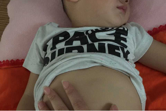 溢奶以及吐奶也是过度喂养表现出的一个症状，偶尔的吐奶以及溢奶是每个宝宝都会出现的一种现象，但频繁的溢奶吐奶，就说明是过度喂养了。