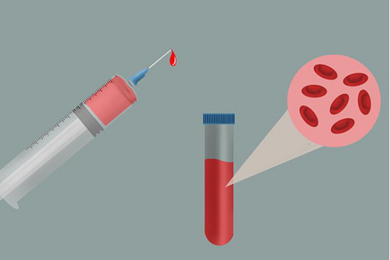 选择足底的血进行检查也是有一定原因，一般来说宝宝的足部血管比较丰富，易于查找，而且足底的痛觉神经相比较于身体其他各个部位来说，是不敏感的，能有效的减少宝宝的疼痛感。