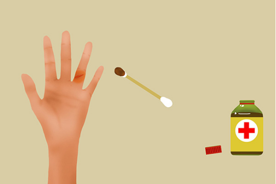 什么伤口需要打破伤风