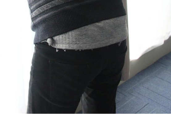 肛门疼痛是什么原因