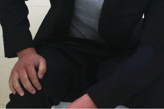 内痔疮便血怎么治