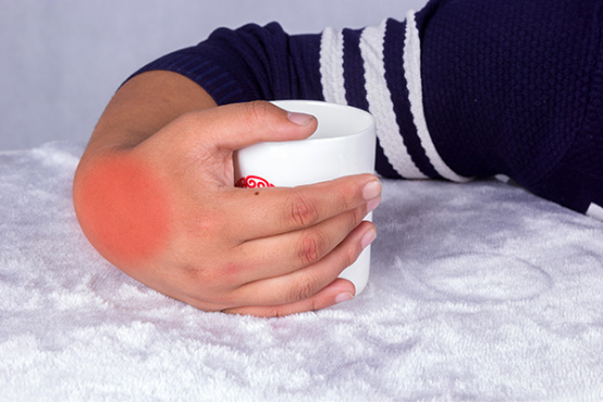 嘌呤是什么 嘌呤是什么