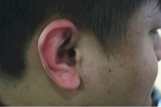 耳朵发烫是什么征兆