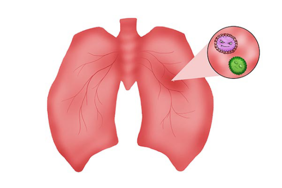 对肺有好处的食物有哪些