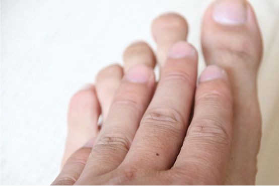 发烧手脚凉和热的区别 发烧手脚凉和热的区别