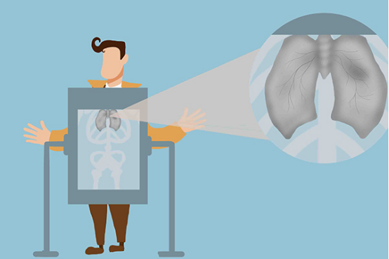 慢性肺炎能自愈吗