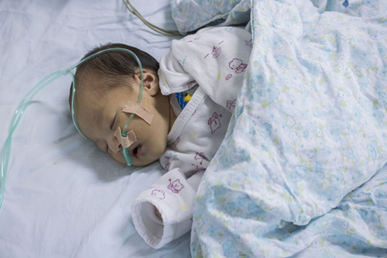 支气管肺炎要住院吗