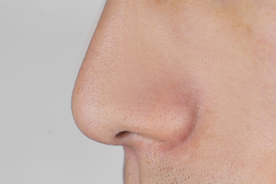 喘气粗是什么原因导致的 喘气粗是什么原因导致的