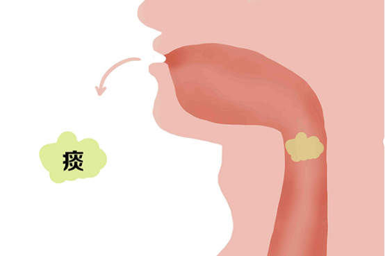 女性不咳嗽但有痰带血是怎么回事