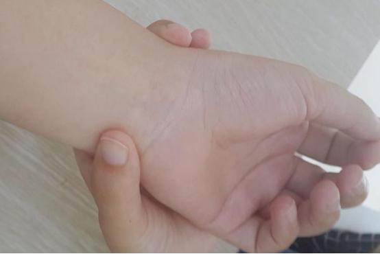 脉搏90是不是太快