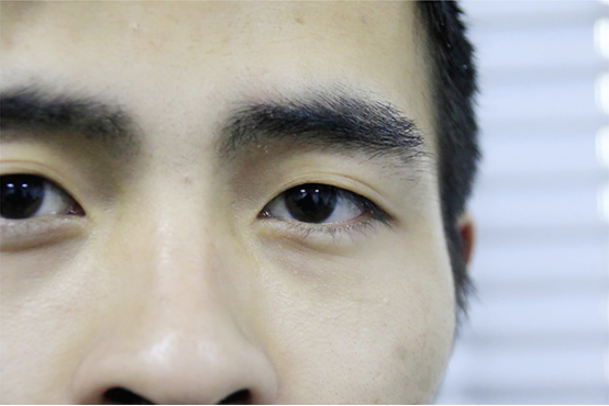 患有红绿色盲的男性和正常的女性生下来的孩子,不论是女宝宝还是男