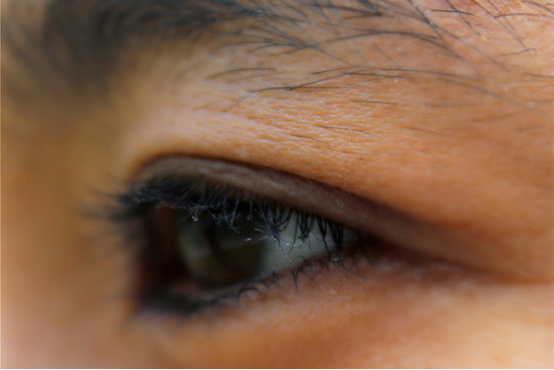 平时不注意保护好自己的眼睛,用眼过度,就会造成眼睛有疼痛感,有些人