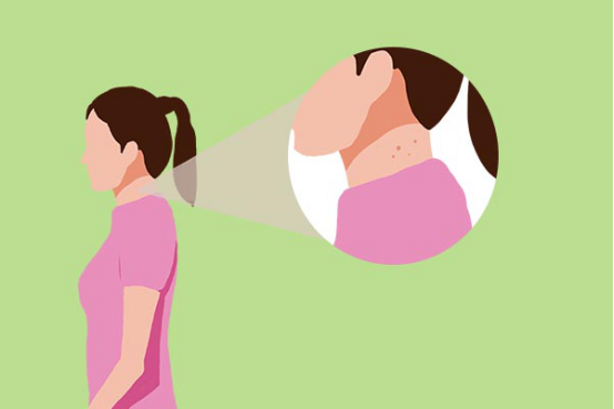 一提到肿瘤,大家就会非常的害怕,确实恶性肿瘤会给身体带来很大的伤害,但是很多的肿瘤是良性的,不需要过于忧虑。 一提到肿瘤,大家就会非常的害怕,确实恶性肿瘤会给身体带来很大的伤害,但是很多的肿瘤是良性的,不需要过于忧虑。