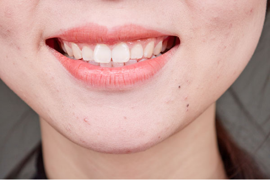 面神经是导致嘴唇轻微发麻出现的常见疾病，同时面神经炎程度比较严重的人群，一侧脸的活动也会受到一定的阻碍，对人们的正常生活以及工作都会造成一定的影响。