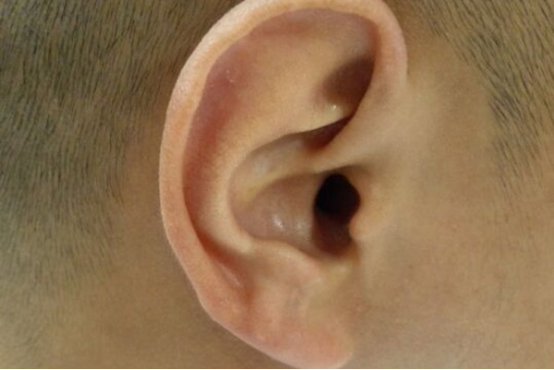 耳朵痒最简单的方法有哪些
