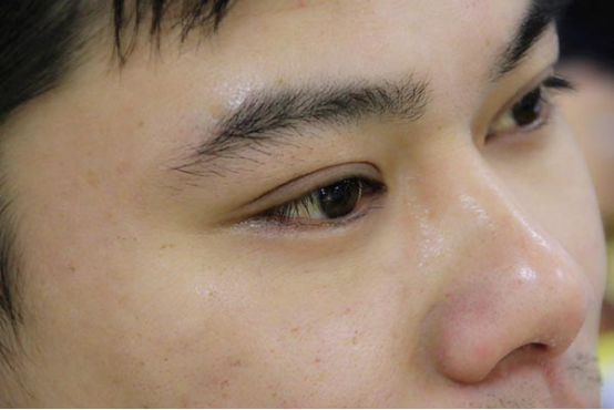 随着电子产品的普及,现在越来越多的人会通过电脑来完成自己的工作,但是这样需要眼睛长时间盯着电脑,眨眼的次数太少,泪液分泌不足的情况下,会让眼睛变得干涩。 随着电子产品的普及,现在越来越多的人会通过电脑来完成自己的工作,但是这样需要眼睛长时间盯着电脑,眨眼的次数太少,泪液分泌不足的情况下,会让眼睛变得干涩。