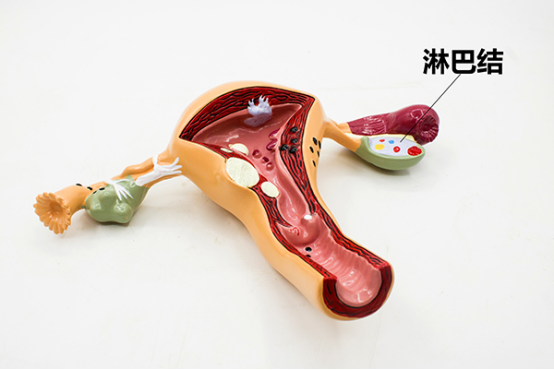 肿瘤跟癌症两个概念，癌症都是恶性的，肿瘤有良性的。