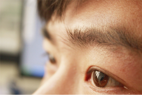 视网膜脱落的症状 视网膜脱落的症状